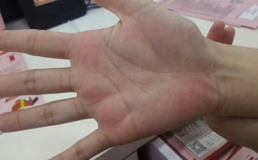 幼儿园手掌树教案6篇