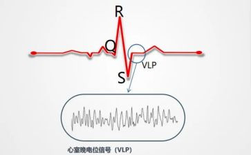 心电图室的自我鉴定8篇